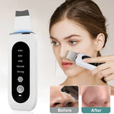 Ultrasonic Blackhead Remover with Microcurrent & LED Light